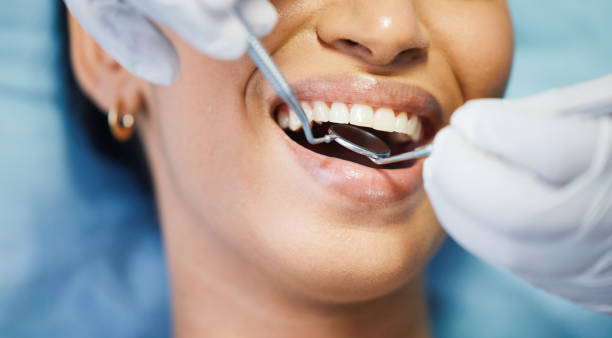 Best Emergency Dental Care for Broken or Chipped Teeth in West Alexandria, OH